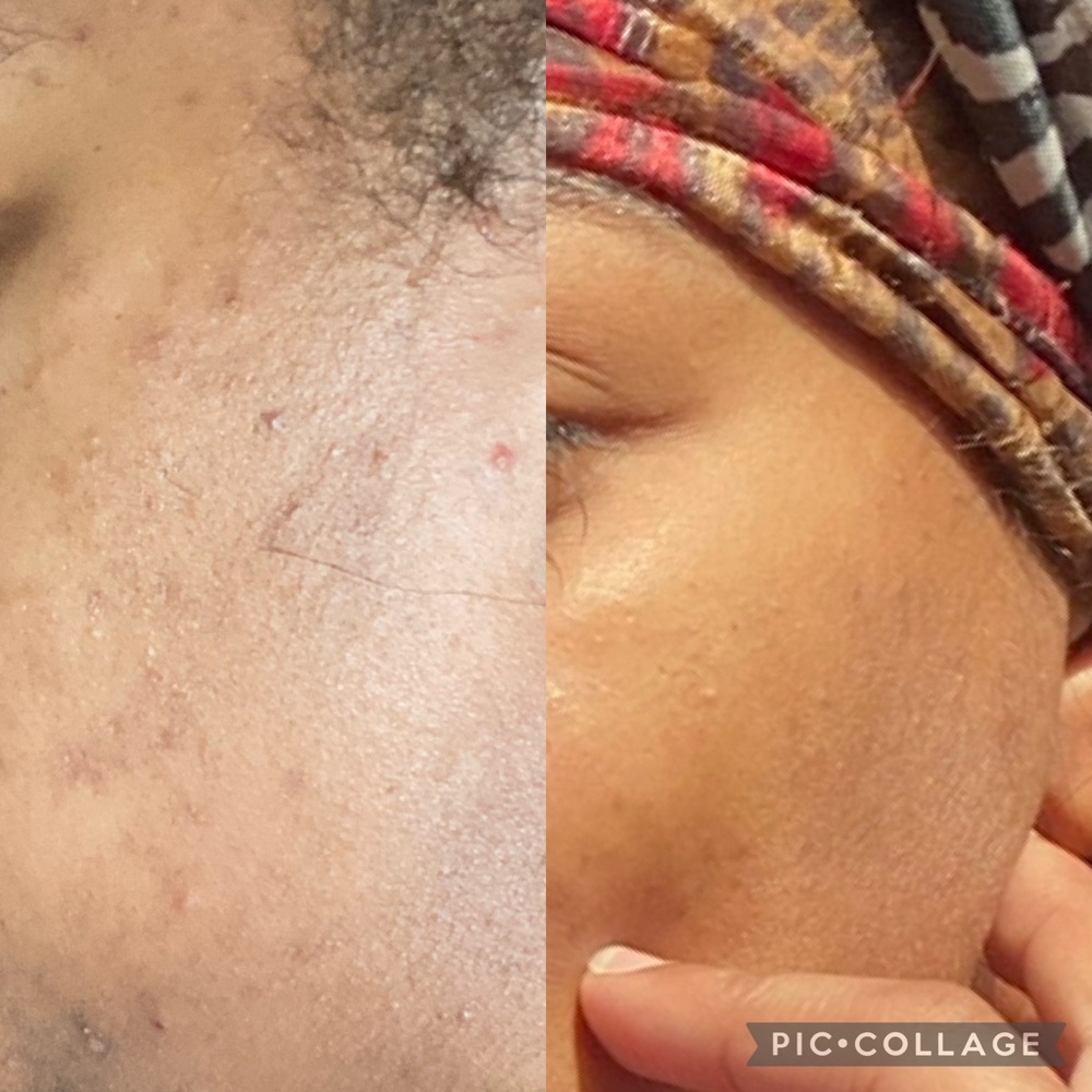 VITAMIN AND MINERAL FORMULATION blended Clay FACE/BODY MASK